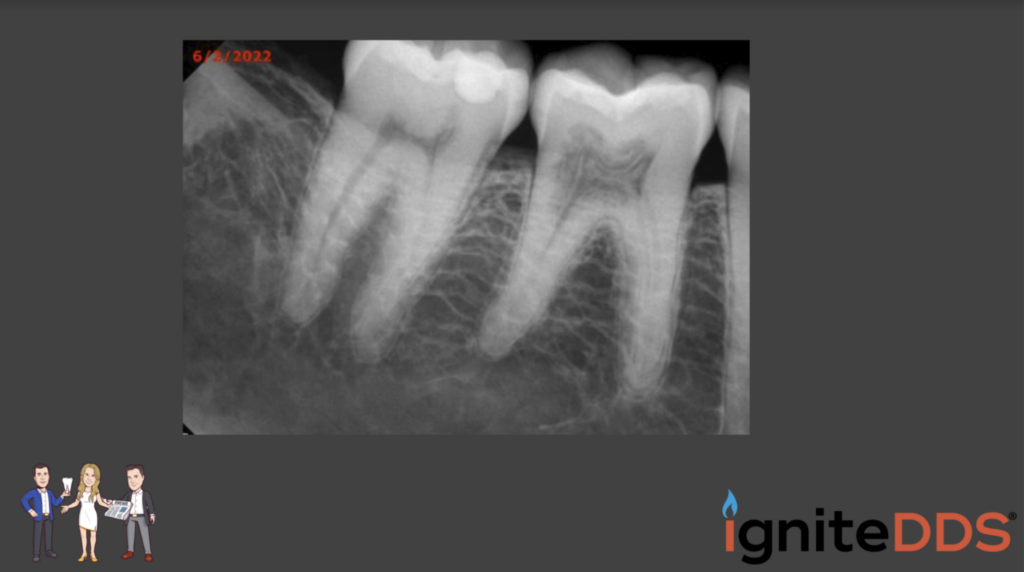 the patient's x-rays